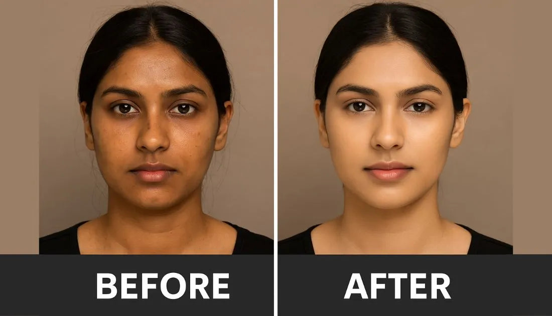 Before and After Transformation 4